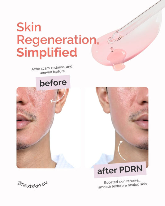 Skin Reset Kit